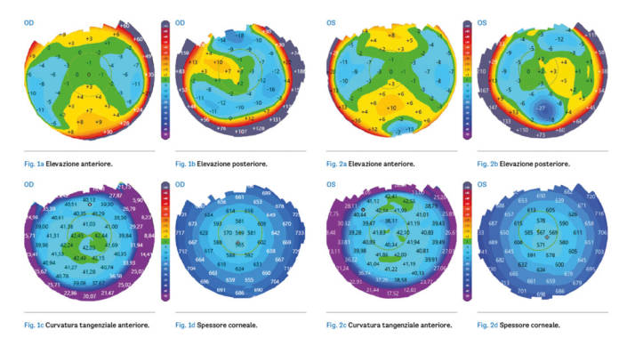 topografia